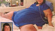 Najteža osoba na svijetu je imala oko 726 kg Najteža osoba na svijetu je imala oko 726 kg