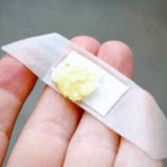 Slabo poznati impresivni efekat bijelog luka Slabo poznati impresivni efekat bijelog luka