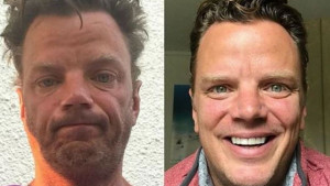 Promjene na licu i tijelu ljudi koji su prestali piti alkohol