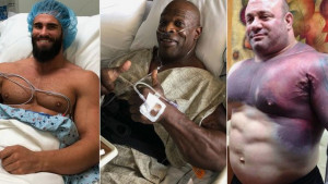 Četiri najgore povrede u bodybuildingu ikada