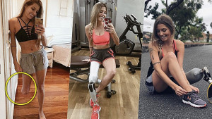 Brazilski fitness model sa nevjerovatnom pričom