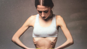 Anoreksija i bulimija – bolesti 21. stoljeća