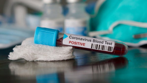 Tri iznenađujuća mita o koronavirusu koji jednostavno nisu istiniti