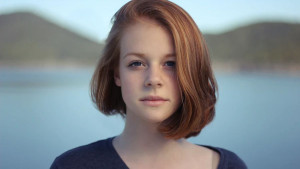 Model sa aknama: Starlie ohrabrila druge djevojke