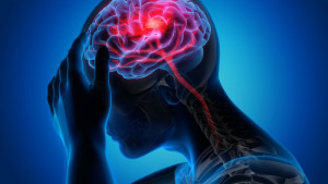 Najčešći uzroci migrene