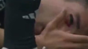 Bešiktaš objavio fotografiju unakaženog fudbalera: "Bez komentara"