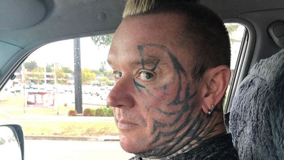 Lee Priest rekao zbogom svojoj tetovaži na licu Lee Priest rekao zbogom svojoj tetovaži na licu