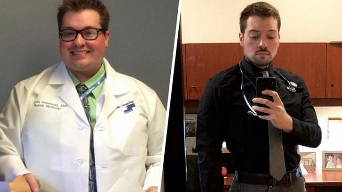 Povremeni post pomogao doktoru da izgubi 56 kilograma za 18 mjeseci Povremeni post pomogao doktoru da izgubi 56 kilograma za 18 mjeseci