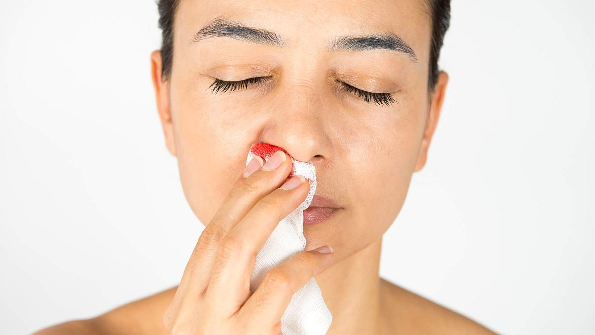 Obilna krvarenja iz nosa – uzroci i prevencija