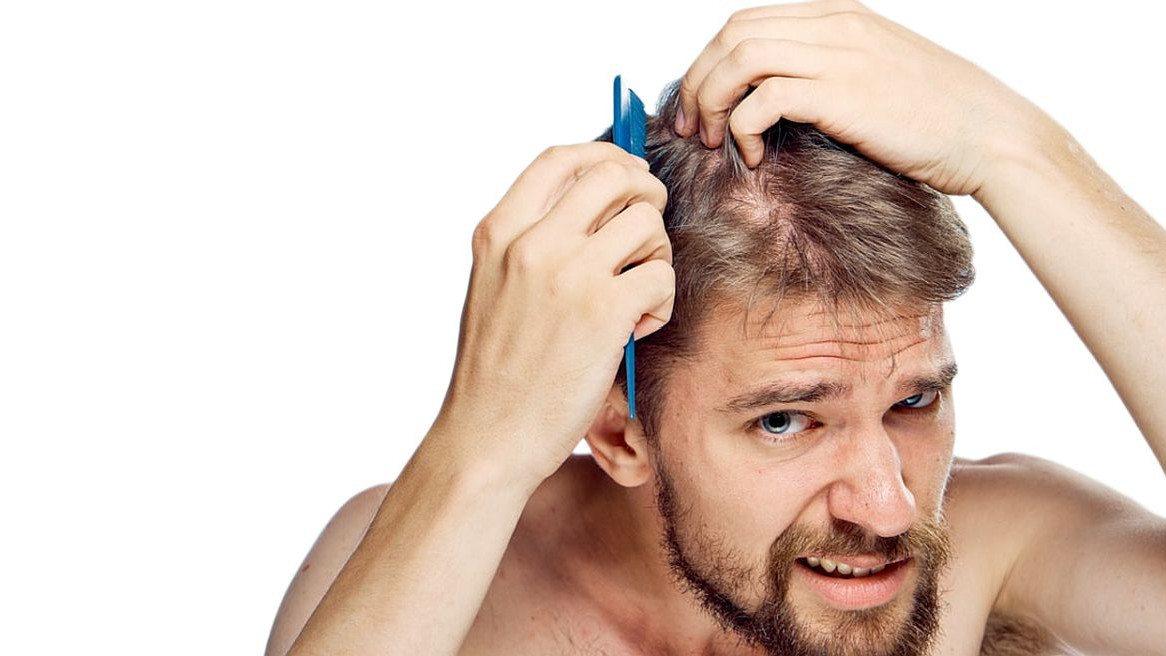 Savjeti za muškarce: Smanjite opadanje kose uz ove trikove