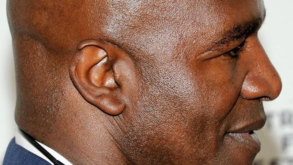 Ovako danas izgleda čuveno Holyfieldovo uho