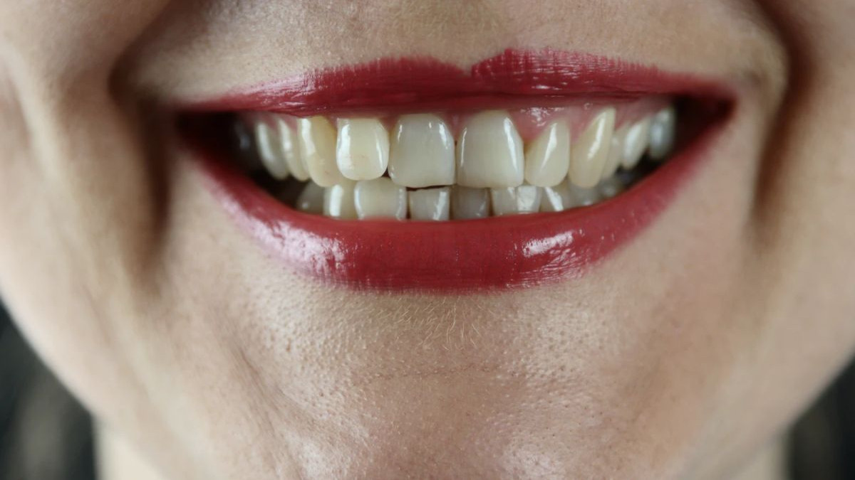Greške zbog kojih žute zubi