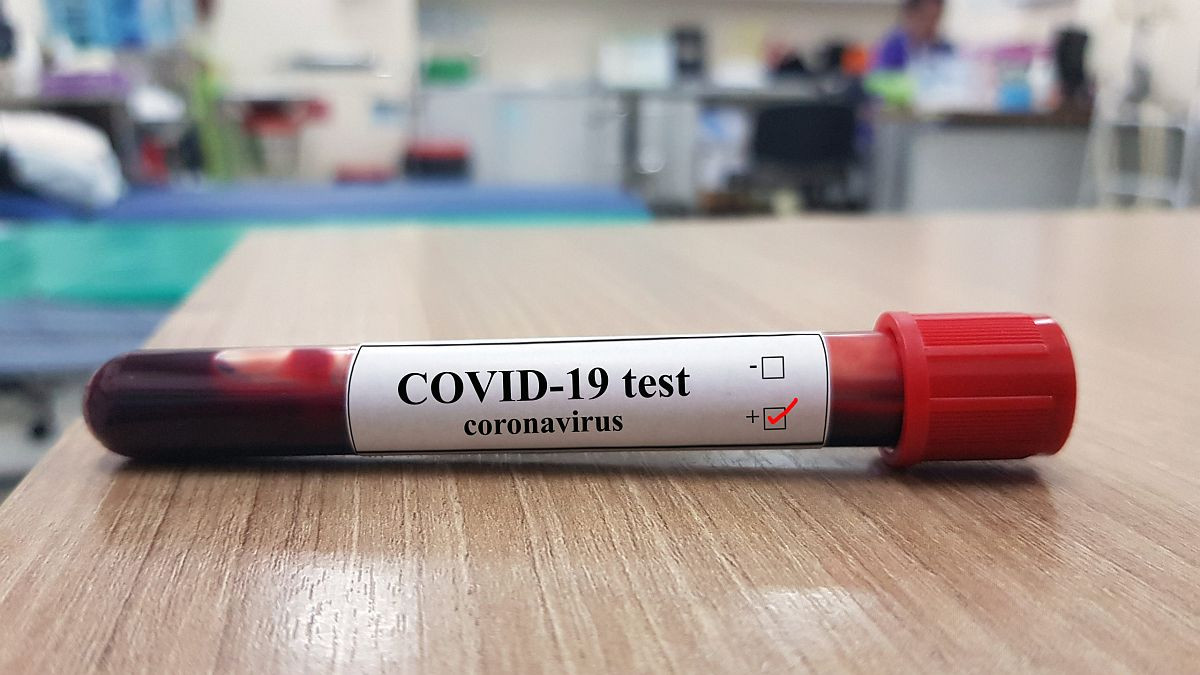 Možete li dva puta oboljeti od koronavirusa?