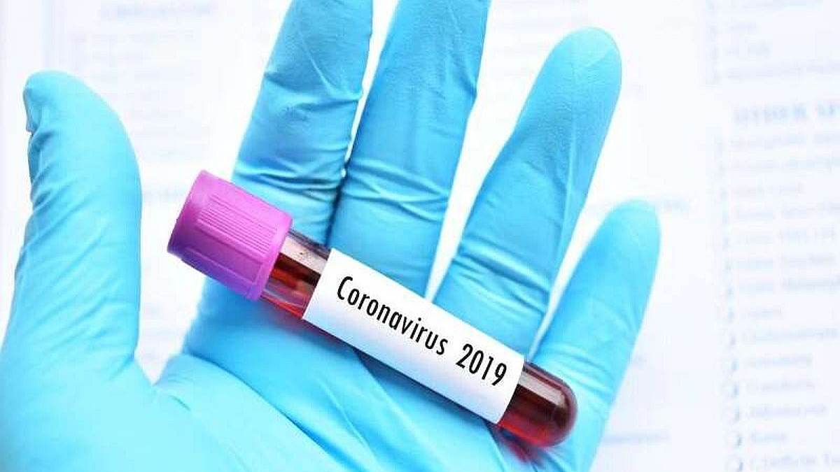 Kako se nositi s anksioznošću zbog koronavirusa?