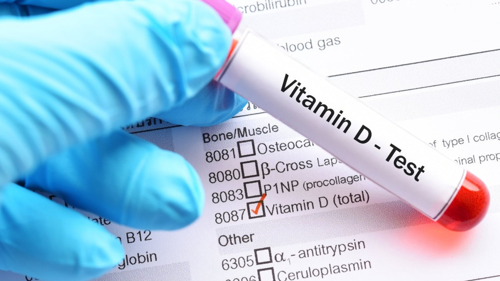  Manjak vitamina u tijelu: 7 znakova da vam nedostaje vitamina D