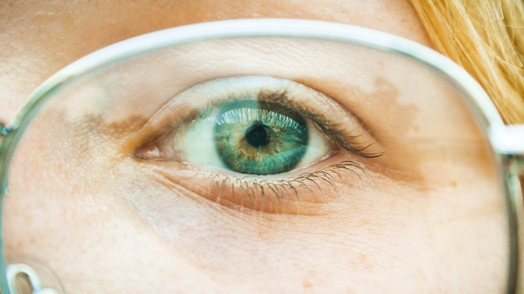Zdravlje očiju: Korisni savjeti za dobar vid