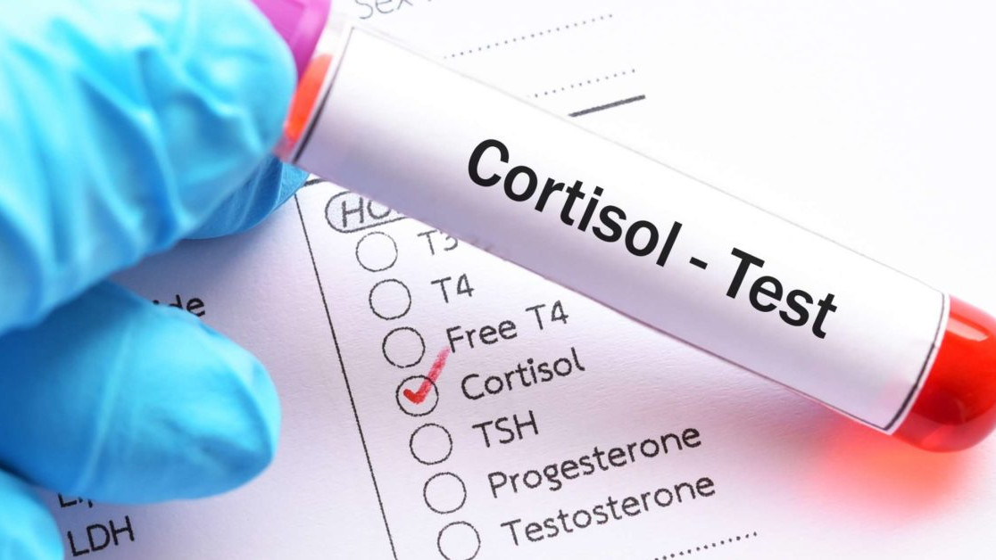 Šta je kortizol i kako ga kontrolisati?