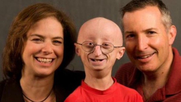 Preminuo "najstariji" tinejdžer na svijetu