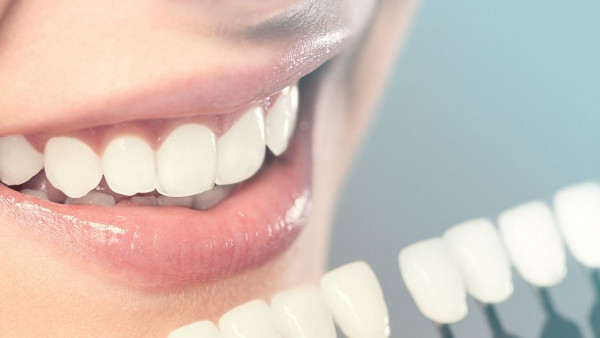 Namirnice koje vam mogu pomoći u izbjeljivanju zuba