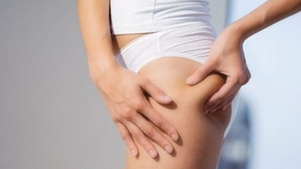 Kako se izboriti sa celulitom na butinama?