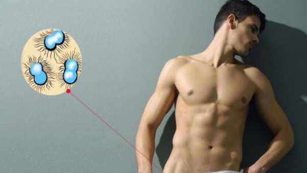 4 rijetke bolesti od kojih obolijevaju muškarci