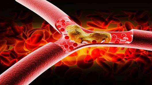 11 načina kako šećer uništava vaše tijelo