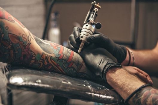 Uklanjanje tetovaža: Sve što treba znati o procesu