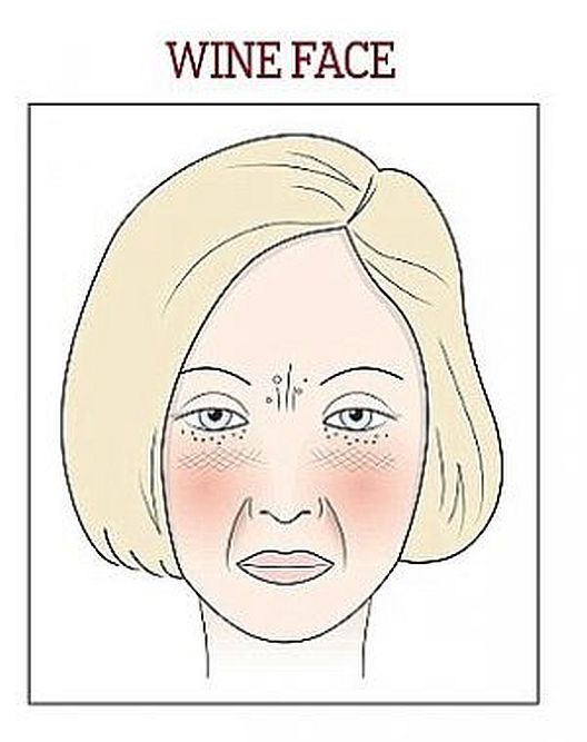 Kako se hraniti ako vidite ove promjene na licu?