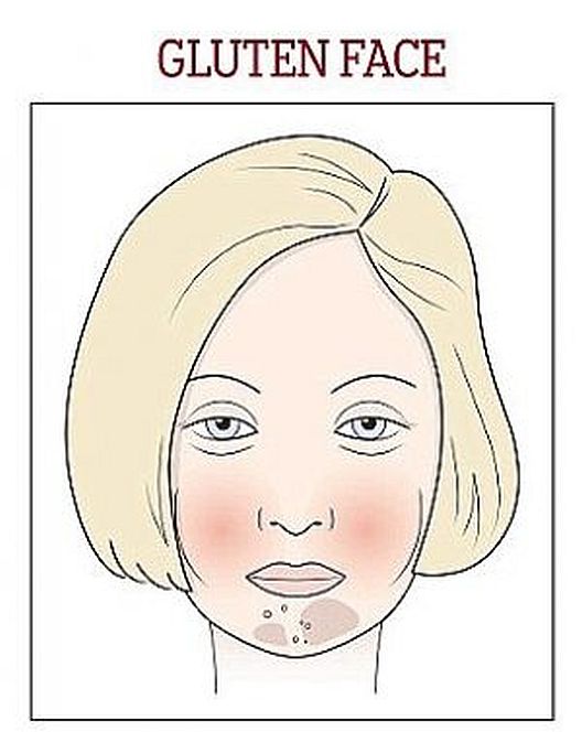 Kako se hraniti ako vidite ove promjene na licu?