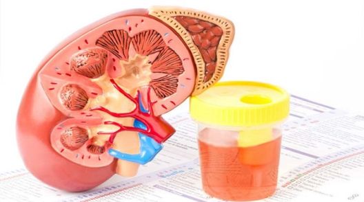 4 rijetke bolesti od kojih obolijevaju muškarci