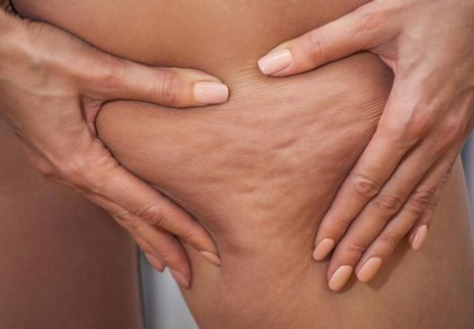 5 zakona mršanja za svaki dio tijela