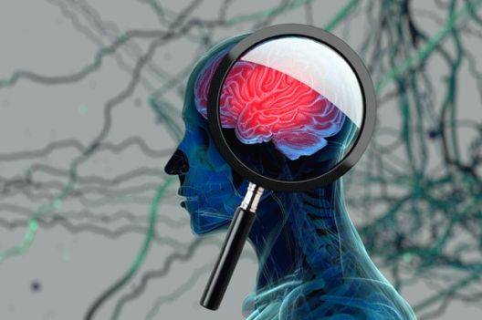 Zašto je so toliko loša za ljudski organizam?