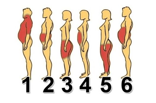 Šest uzroka i šest različitih vrsta debljanja