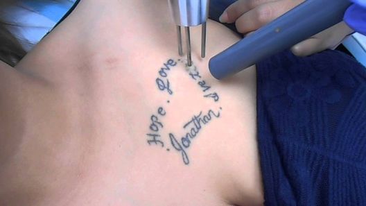 Zašto se ljudi najčešće pokaju nakon tetoviranja?