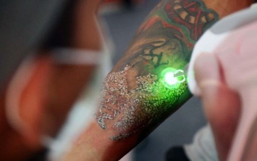 Zašto se ljudi najčešće pokaju nakon tetoviranja?