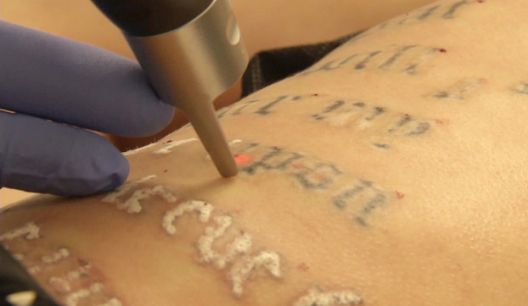 Zašto se ljudi najčešće pokaju nakon tetoviranja?