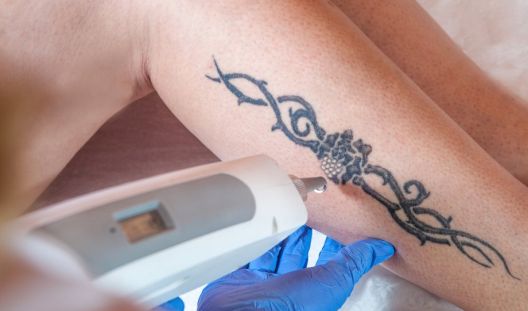 Zašto se ljudi najčešće pokaju nakon tetoviranja?