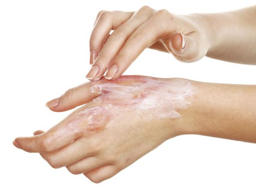 Šta morate imati u kućnoj apoteci? Šta morate imati u kućnoj apoteci?