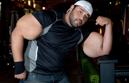 Sedam divova koje je bodybuilding odveo predaleko