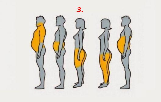 Pet tipova gojaznosti i njihovi uzročnici