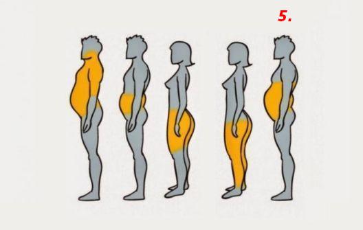 Pet tipova gojaznosti i njihovi uzročnici