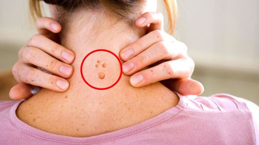 8 simptoma koje žene ne smiju zanemariti