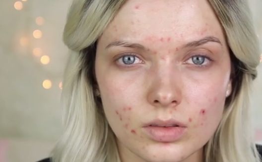 8 znakova upozorenja da unosite previše šećera