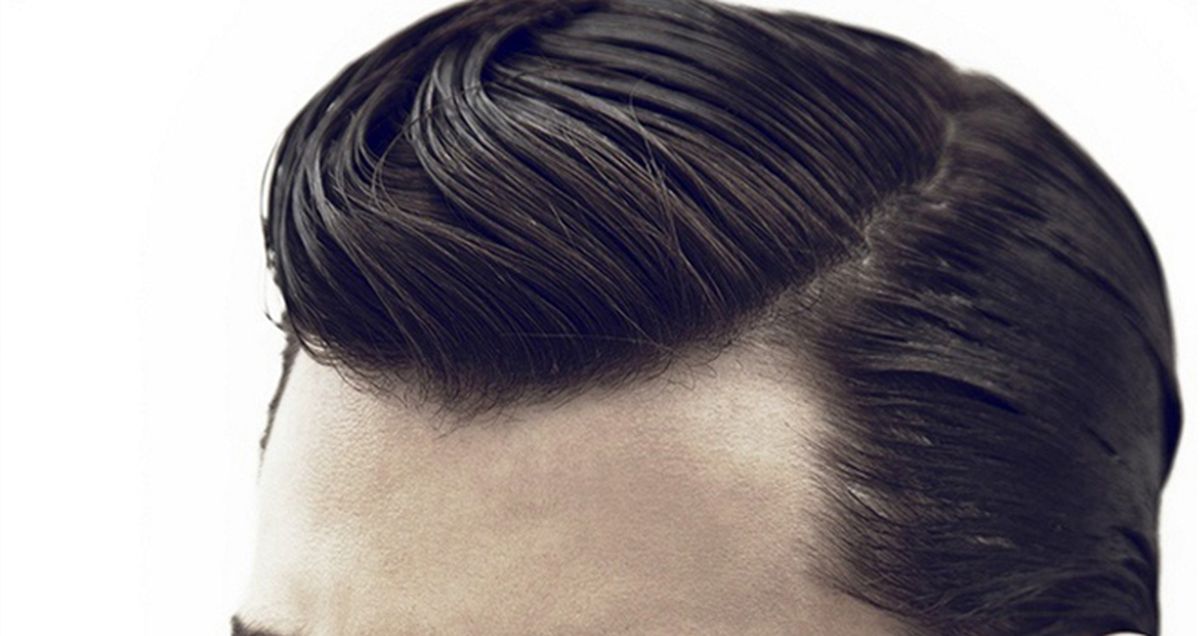 Kako izbjeći opadanje kose Kako izbjeći opadanje kose