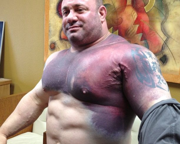 Četiri najgore povrede u bodybuildingu ikada