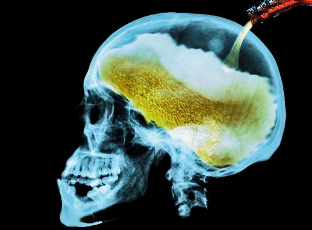 Utjecaj alkohola na mozak