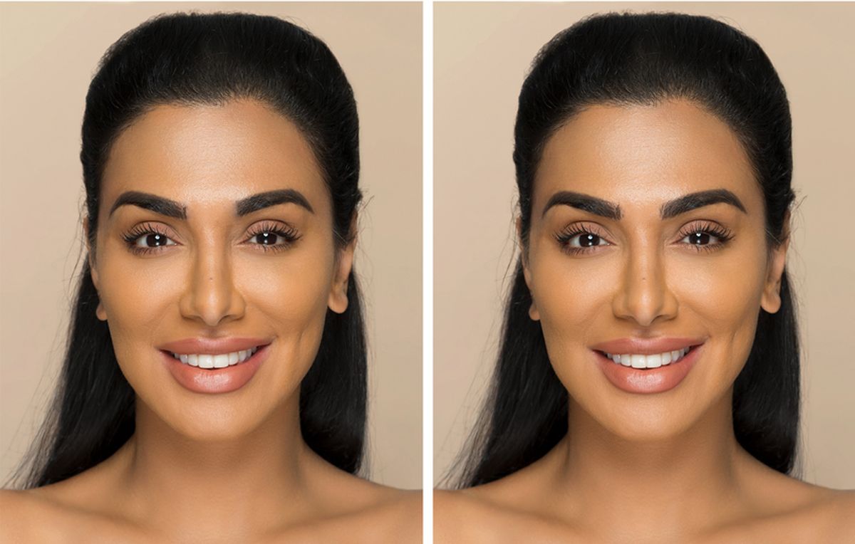 Kako učini nos užim?