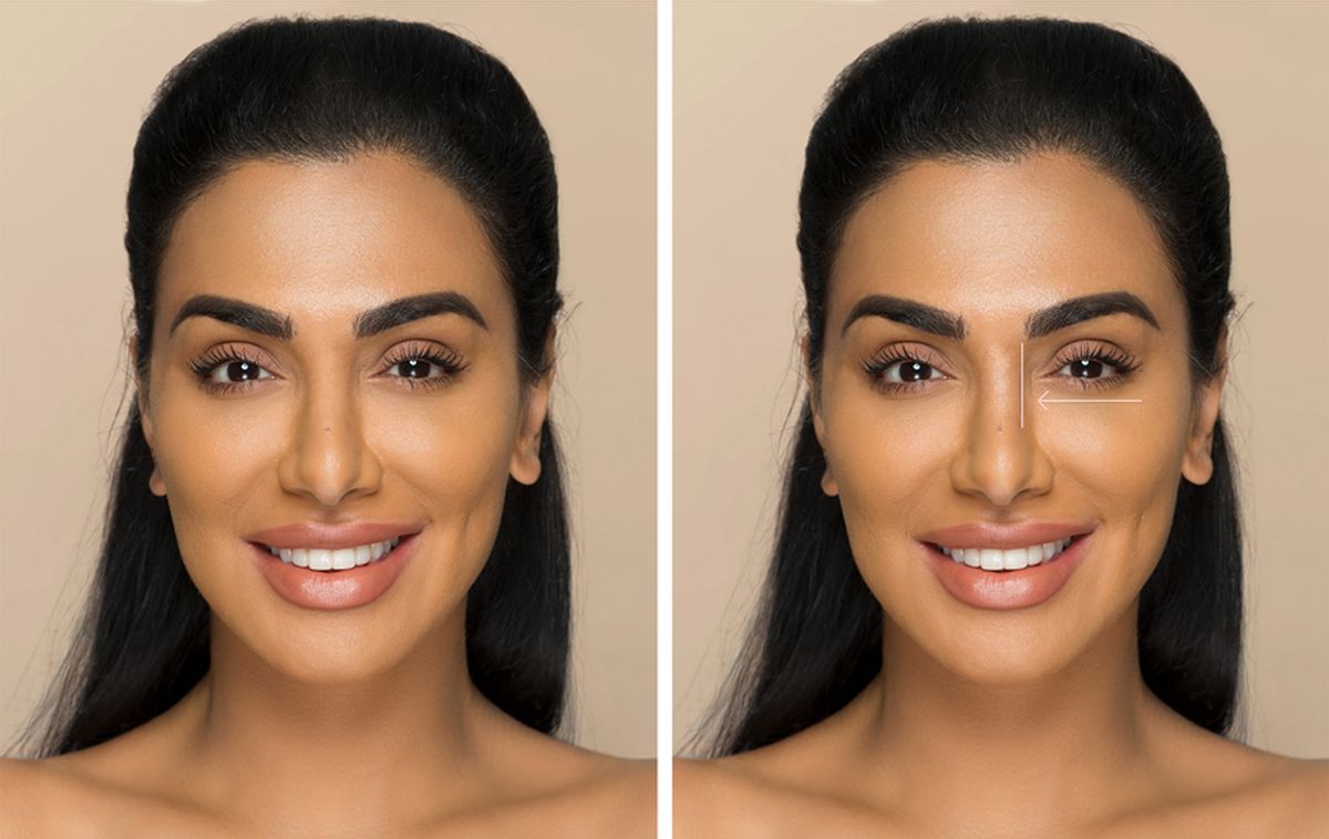 Kako učini nos užim?