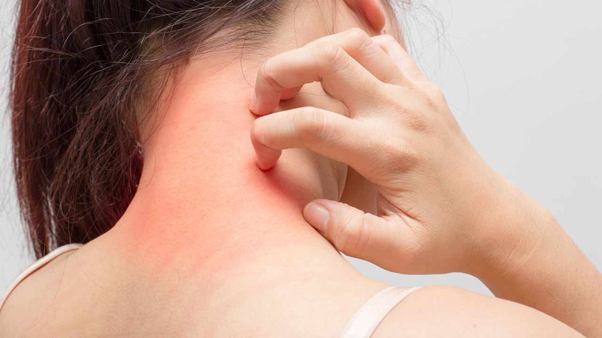 Kako stres utječe na kožu 
