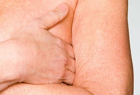 Kako pušenje utječe na vaš izgled?